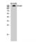 Collagen Type IV Alpha 1 Chain antibody, LS-C382809, Lifespan Biosciences, Western Blot image 