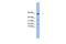 LYR motif-containing protein 1 antibody, GTX44917, GeneTex, Western Blot image 