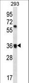 Olfactory Receptor Family 52 Subfamily E Member 2 antibody, LS-C163218, Lifespan Biosciences, Western Blot image 