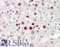 DOT1 Like Histone Lysine Methyltransferase antibody, LS-C789606, Lifespan Biosciences, Immunohistochemistry paraffin image 