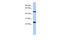 Transmembrane Protein 161B antibody, 26-755, ProSci, Western Blot image 