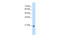 Methyltransferase Like 7A antibody, 29-746, ProSci, Western Blot image 