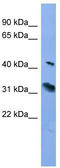 Rhodopsin antibody, TA342775, Origene, Western Blot image 