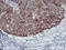 Sequestosome 1 antibody, LS-C337180, Lifespan Biosciences, Immunohistochemistry paraffin image 