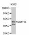 Matrix Metallopeptidase 13 antibody, abx126974, Abbexa, Western Blot image 