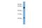 D-Aminoacyl-TRNA Deacylase 2 antibody, A17139, Boster Biological Technology, Western Blot image 