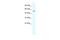 Regulator Of G Protein Signaling 6 antibody, A05753, Boster Biological Technology, Western Blot image 