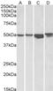 Integrin Linked Kinase antibody, 42-724, ProSci, Western Blot image 