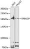 ERBIN antibody, A06036, Boster Biological Technology, Western Blot image 