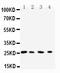 Ras-related protein Rab-3C antibody, PA2279, Boster Biological Technology, Western Blot image 