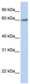 Transmembrane 9 Superfamily Member 1 antibody, TA335691, Origene, Western Blot image 