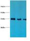 Lipocalin 2 antibody, LS-C211185, Lifespan Biosciences, Western Blot image 