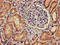Protein Kinase CAMP-Activated Catalytic Subunit Beta antibody, LS-C679164, Lifespan Biosciences, Immunohistochemistry paraffin image 