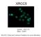 X-Ray Repair Cross Complementing 5 antibody, 28-007, ProSci, Immunohistochemistry paraffin image 