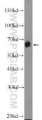 Polypeptide N-Acetylgalactosaminyltransferase 9 antibody, 25967-1-AP, Proteintech Group, Western Blot image 