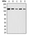 BOC Cell Adhesion Associated, Oncogene Regulated antibody, orb377955, Biorbyt, Western Blot image 