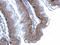 Junction Plakoglobin antibody, GTX114156, GeneTex, Immunohistochemistry paraffin image 