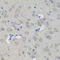 Aconitase 1 antibody, 19-974, ProSci, Immunohistochemistry paraffin image 