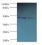 Perilipin 2 antibody, MBS1498455, MyBioSource, Western Blot image 