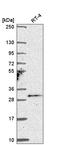 Testis Specific Serine Kinase 4 antibody, HPA060660, Atlas Antibodies, Western Blot image 