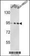 Valosin Containing Protein antibody, MBS9201727, MyBioSource, Western Blot image 
