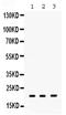 HRas Proto-Oncogene, GTPase antibody, A00114, Boster Biological Technology, Western Blot image 