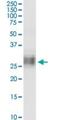 Bone Marrow Stromal Cell Antigen 2 antibody, H00000684-M15, Novus Biologicals, Western Blot image 