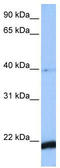 HBS1 Like Translational GTPase antibody, TA340122, Origene, Western Blot image 