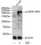 EGFR antibody, A00023Y845, Boster Biological Technology, Western Blot image 