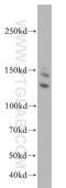 Codanin-1 antibody, 17597-1-AP, Proteintech Group, Western Blot image 