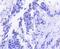 RB Transcriptional Corepressor 1 antibody, A00039-1, Boster Biological Technology, Immunohistochemistry paraffin image 
