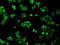 Heterogeneous Nuclear Ribonucleoprotein F antibody, GTX84356, GeneTex, Immunofluorescence image 