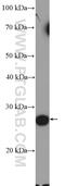 Tubulin Polyglutamylase Complex Subunit 1 antibody, 26113-1-AP, Proteintech Group, Western Blot image 