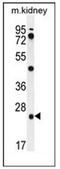 Pyroglutamyl-Peptidase I antibody, AP53272PU-N, Origene, Western Blot image 