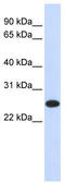 Interleukin 33 antibody, TA339875, Origene, Western Blot image 