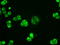 Adenylate Kinase 1 antibody, LS-C784166, Lifespan Biosciences, Immunofluorescence image 