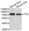 Tyrosinase antibody, LS-C331387, Lifespan Biosciences, Western Blot image 