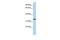 M4A4A antibody, GTX44847, GeneTex, Western Blot image 