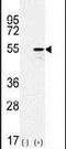 Cytochrome P450 Family 26 Subfamily B Member 1 antibody, PA5-15214, Invitrogen Antibodies, Western Blot image 