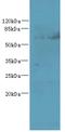 Tetratricopeptide Repeat Domain 30B antibody, MBS1493723, MyBioSource, Western Blot image 