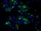 ATP Synthase F1 Subunit Beta antibody, LS-C114908, Lifespan Biosciences, Immunofluorescence image 