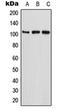 ETAA1 Activator Of ATR Kinase antibody, orb215199, Biorbyt, Western Blot image 