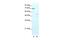 Zinc Finger Protein 665 antibody, PA5-41177, Invitrogen Antibodies, Western Blot image 