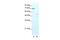 Zinc Finger Protein 665 antibody, PA5-41177, Invitrogen Antibodies, Western Blot image 