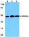 Serpin Family B Member 4 antibody, A07524-1, Boster Biological Technology, Western Blot image 