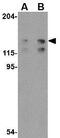 ADAP antibody, GTX31318, GeneTex, Western Blot image 