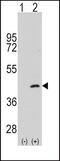 Mitogen-Activated Protein Kinase Kinase 4 antibody, PA5-15100, Invitrogen Antibodies, Western Blot image 