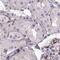 Treacle Ribosome Biogenesis Factor 1 antibody, PA5-58308, Invitrogen Antibodies, Immunohistochemistry frozen image 