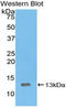 C-X-C Motif Chemokine Ligand 8 antibody, LS-C294946, Lifespan Biosciences, Western Blot image 