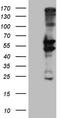 Peripherin antibody, LS-C339888, Lifespan Biosciences, Western Blot image 